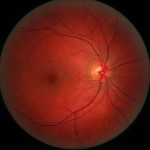 eye_retina