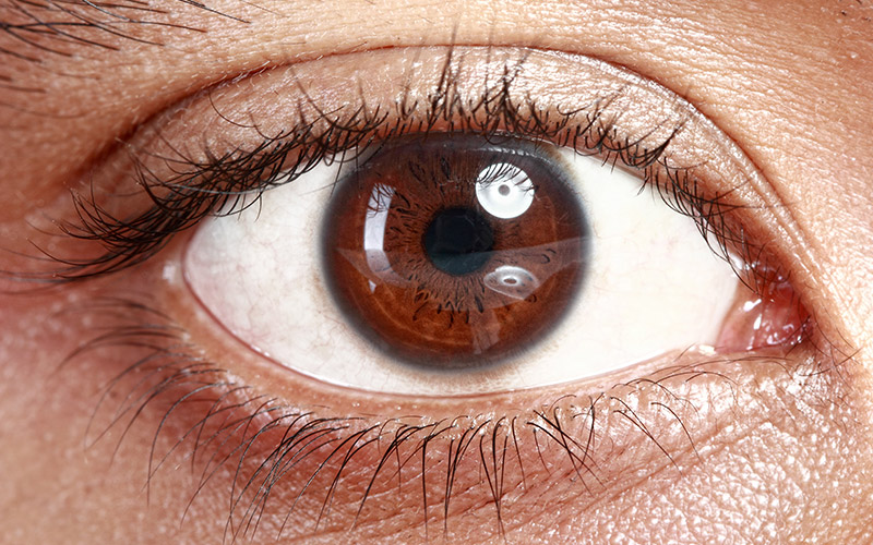 Eye MI Toric Lens Implants
