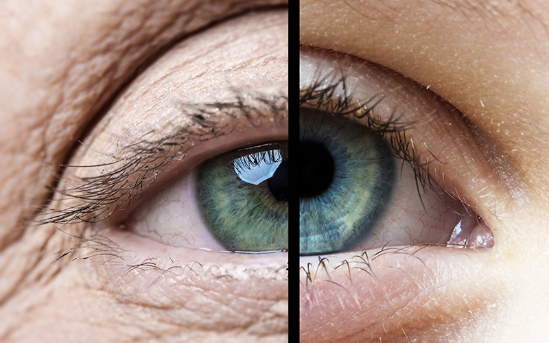 What Happens to Your Eyes as You Age? - Grosinger, Spigelman & Grey