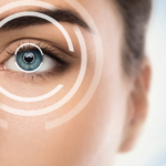 LASIK Eye Surgery