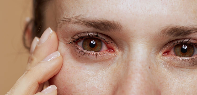 Urgent Eye Care